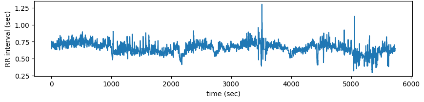 HRV Physiological Synchrony Analysis preview